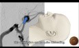 Direction du Fundus Anévrismal