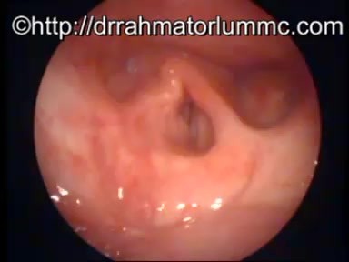 Le Larynx (Organe de la Phonation) - Absence de l'Epiglotte 