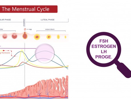 Adolescence avec des saignements menstruels abondants