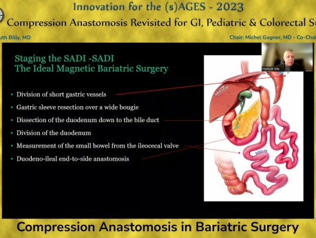 Anastomose par Compression en Chirurgie Bariatrique