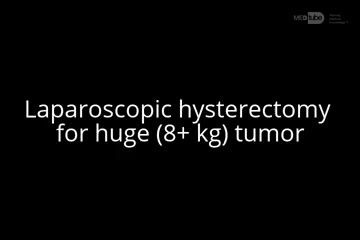 Hystérectomie Laparoscopique pour une Tumeur de Plus de 8 kg