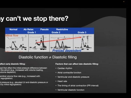 Évaluation Echocardiographique de la Fonction Diastolique