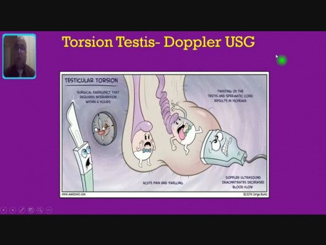 La torsion testiculaire.