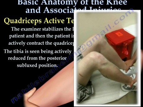 Anatomie du genou et blessures