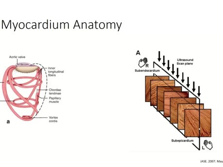 Guide Pratique de l'Echocardiographie SLG (Strain Longitudinal Global) par Speckle Tracking 2D 