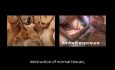 Vidéos Chirurgicales pour l'Anatomie