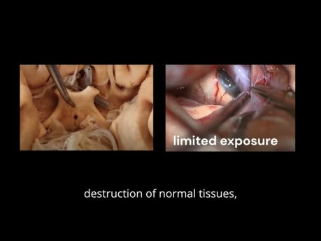 Vidéos Chirurgicales pour l'Anatomie