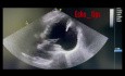 Échocardiographie - Que voyez-vous ?