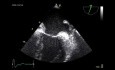 Quiz de l'échocardiographie transoesophagienne (résultat anormal) et une révision de certaines image de base