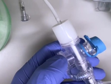 Bronchoscopie plus Sûre chez les Patients Trachéotomisés pendant le COVID-19