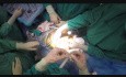Cystectomie radicale par laparoscopie