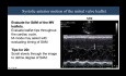 Cardiomyopathie Hhypertrophique à l'Echographie : Conseils Pratiques et Questions Fréquentes