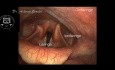 Anatomie ORL endoscopique