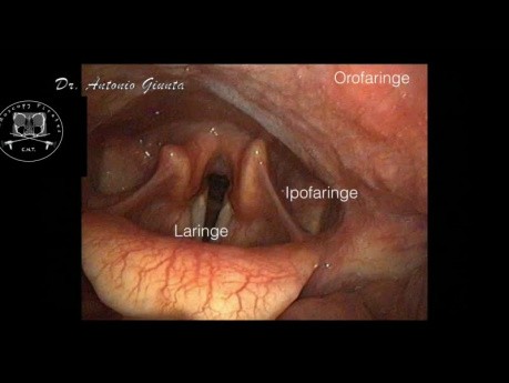 Anatomie ORL endoscopique