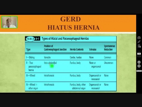 Reflux gastro-œsophagien - dysphagie