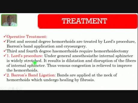 Hémorroïdes - saignement gastro-intestinal inférieur