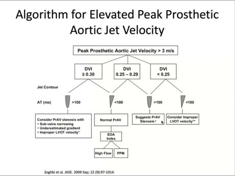 Évaluation Echographique des Valves Prothétiques avec des Débits Elevés