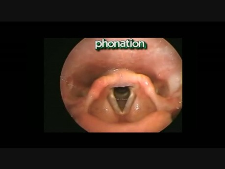 Mouvements du Larynx