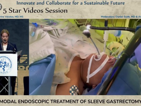 Traitement Endoscopique Multimodal des Lâchages de Gastrectomie Sleeve