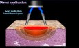 Utilisation sûre de l'électrochirurgie - un aperçu