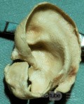 Le cartilage auriculaire