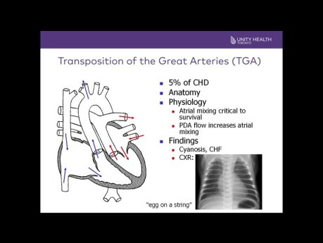 Introduction aux Echocardiogrammes Pédiatriques et aux Cardiopathies Congénitales Critiques Courantes