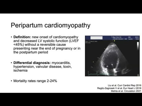 Échocardiographie chez la Femme Enceinte