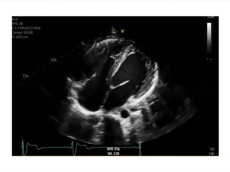 Cas Intéressants au Laboratoire d'Echographie de l'Hôpital St. Michael