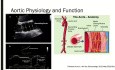 Échocardiographie des Maladies de l'Aorte- Ce Que Vous Voulez Savoir sur l'Aorte