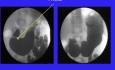 Les sphincters du tractus oeso-gastro-intestinal