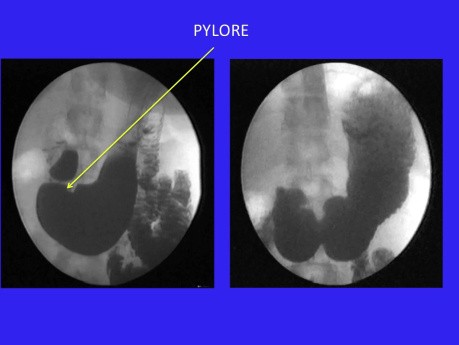 Les sphincters du tractus oesophageogastrointestinal