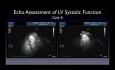 Une Approche Pratique de la Fraction d'Ejection Ventriculaire gauche (FEVG) en Echocardiographie