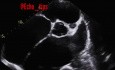 10. Cas d'échocardiographie - Quelle est la vue, les structures et le résultat ?