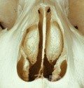 Concha bullosa bilatérale [spécimen ostéologique]