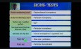 Varices des membres inférieurs.