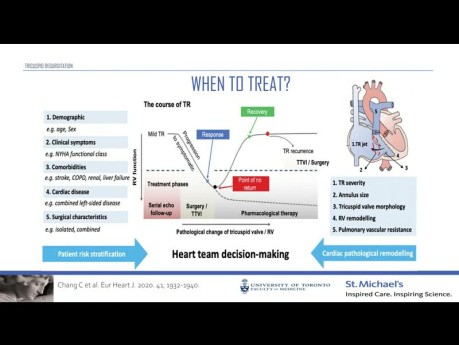 Importance de la Régurgitation Tricuspide chez les Patients Insuffisants Cardiaques