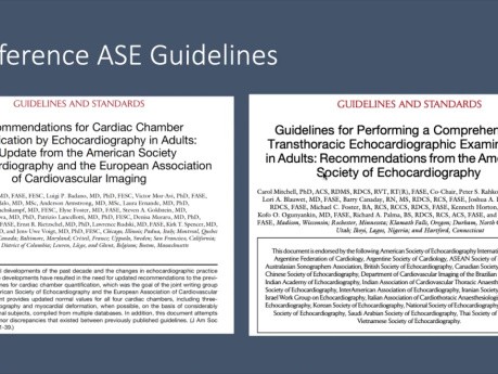 Quantification des Cavités en Echocardiographie