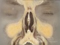 Anatomie coronale du nez et des sinus paranasaux: tranche 1