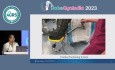 Hystérectomie Complexe pour Pathologie Bénigne avec Assistance Robotique