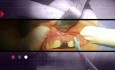 Placement d'implant frais