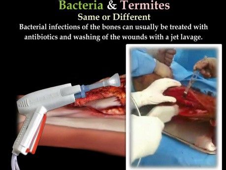 Infection bactérienne & termites - comparaison