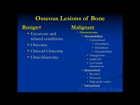 Cours d'oncologie orthopédique - Tumeurs osseuses primitives (ostéoblastome, ostéome ostéoïde) - Conférence 3