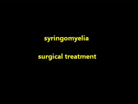 Syringomyélie - Traitement Microchirurgical