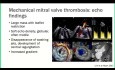 Évaluation Echocardiographique des Valves Mitrales Prothétiques