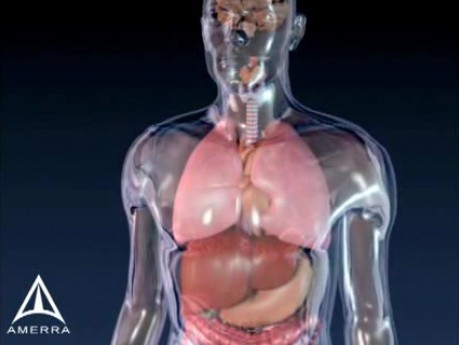 L'asthme - animation médicale 3D