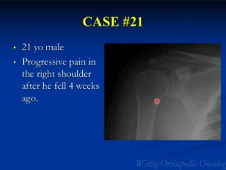 Cours d'oncologie orthopédique - des cas inconnus du test partie C (21-29) - Cours 13