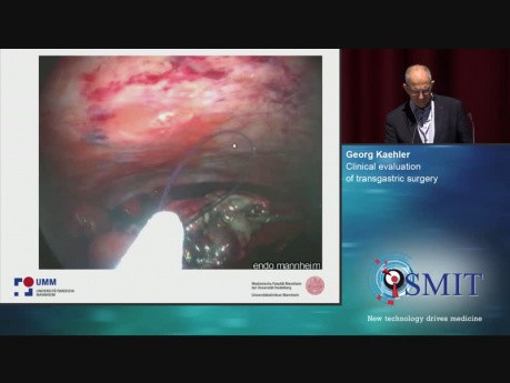 Évaluation clinique de la chirurgie transgastrique - SMIT 2019