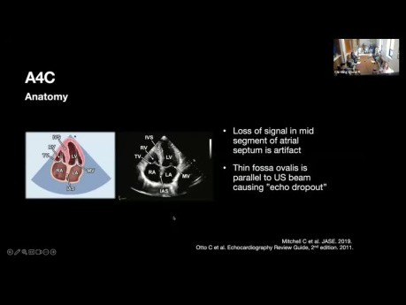 Programme de Base Echo: Echocardiographie Transthoracique Intégrale