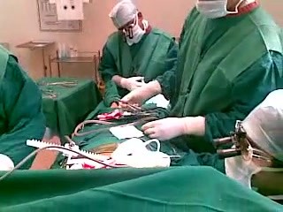 Le pontage aorto-coronarien chez un patient lucide (anesthésie épidurale)