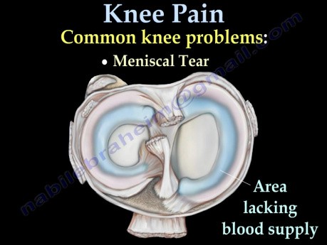 Douleur du genou - Causes fréquentes